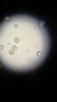 Urate Crystals Viewed Under A Microscope, Faecal Smear Of A Hecks Grass Finch