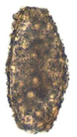 Ascaris Lumbricoides Infertile