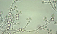 Candida Budding Viewed under A Microscope, Magnification x40